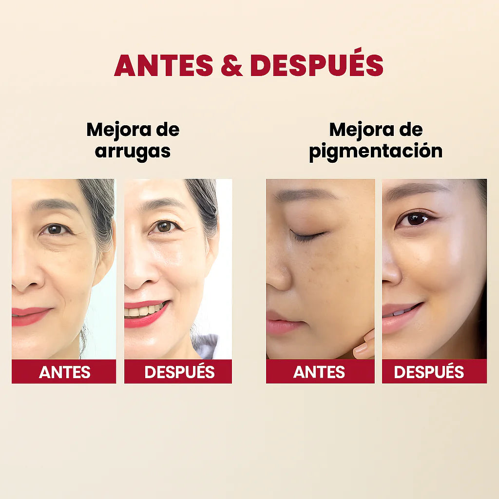 Seoul 1988: Liposoma de retina al 2% + Ginseng negro